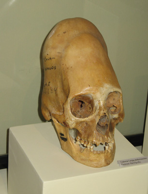 Shaped Skull Ica Regional Museum, Nazca, Peru 2007