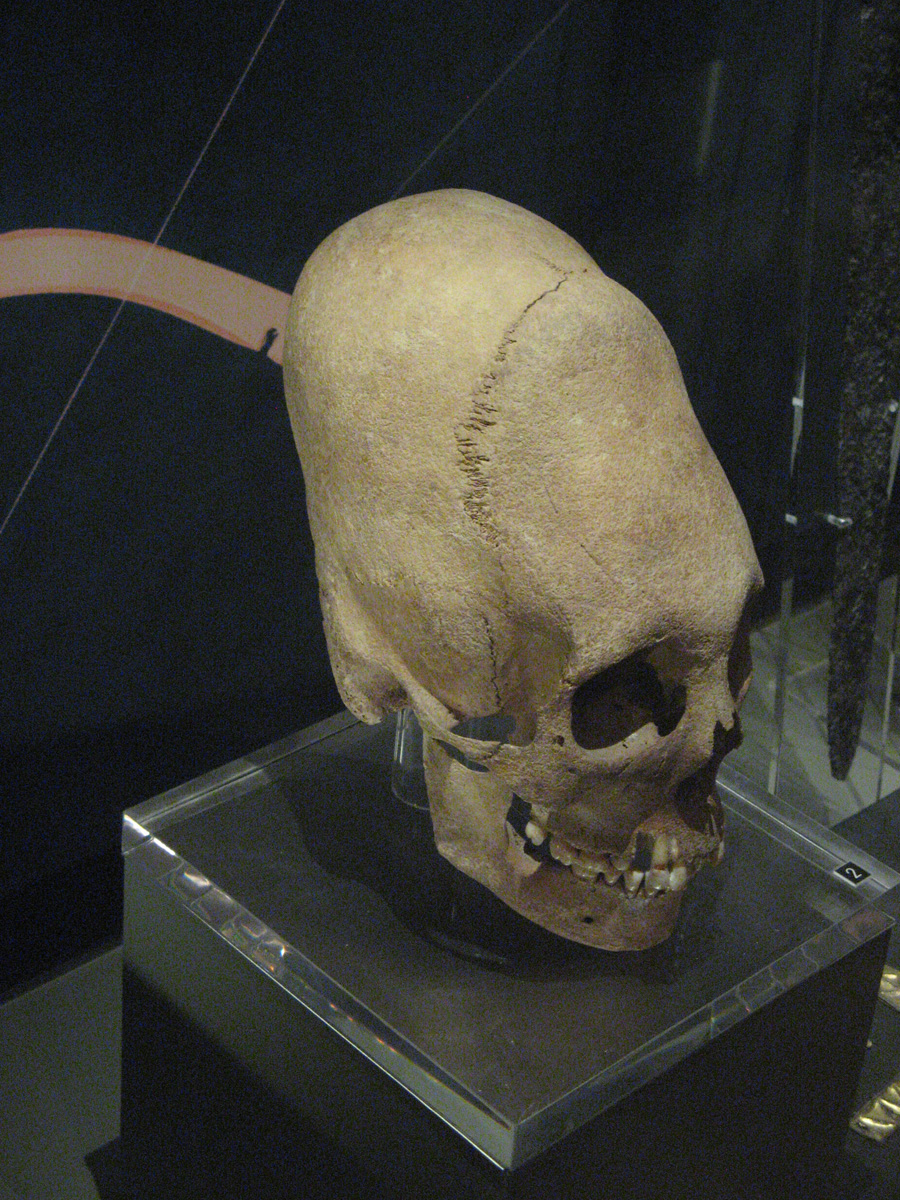 Budapest, Yet another distorted skull