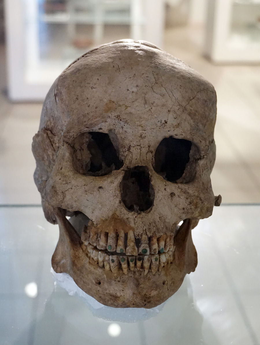 Copan Ruinas Town Museum, Skull with jade inlays in teeth