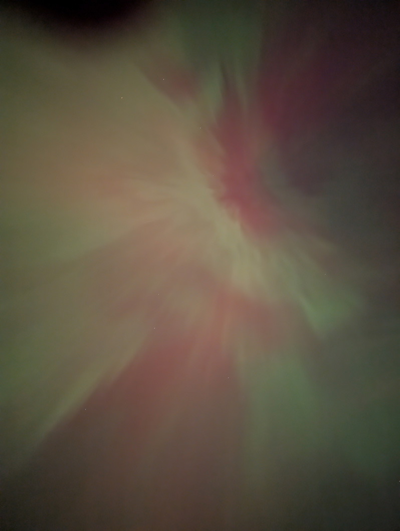 Aurora Borealis, Overhead