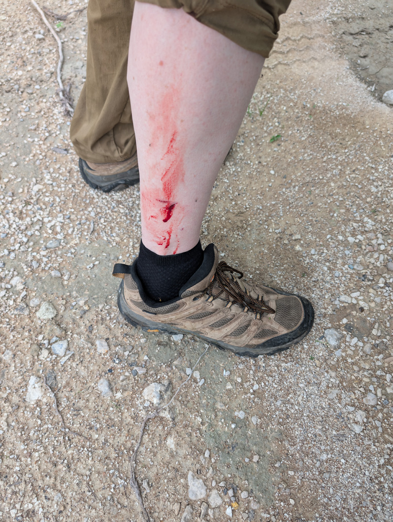 Nauru: Dog Bite, The Bite